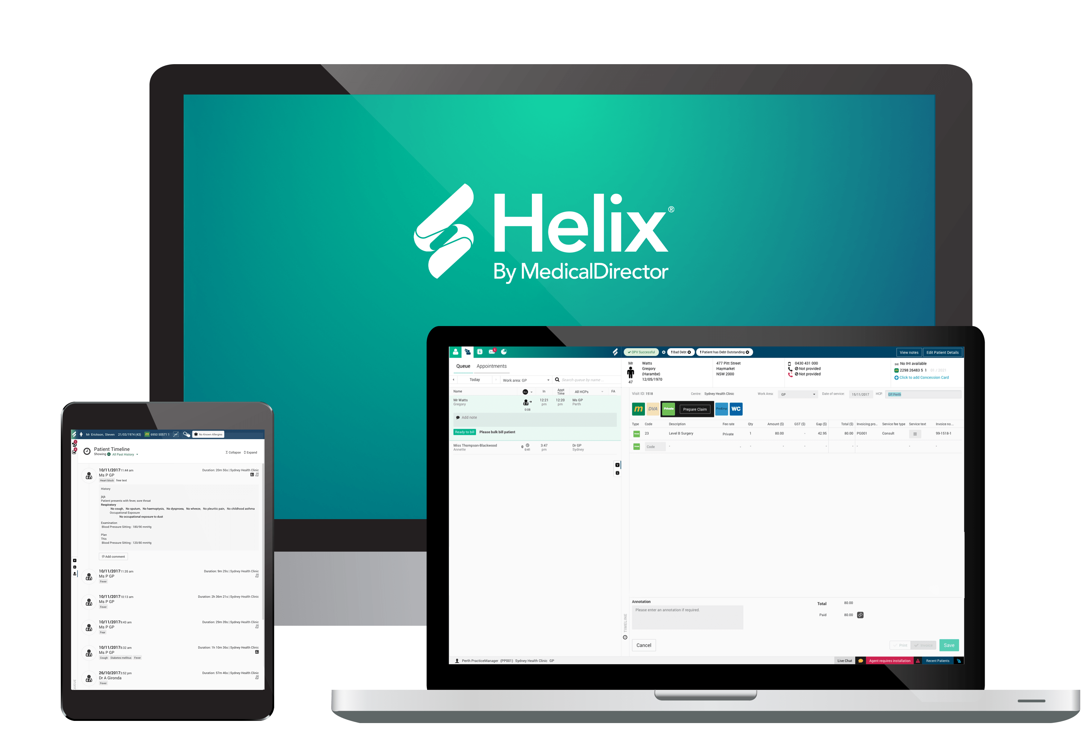 Helix on screens